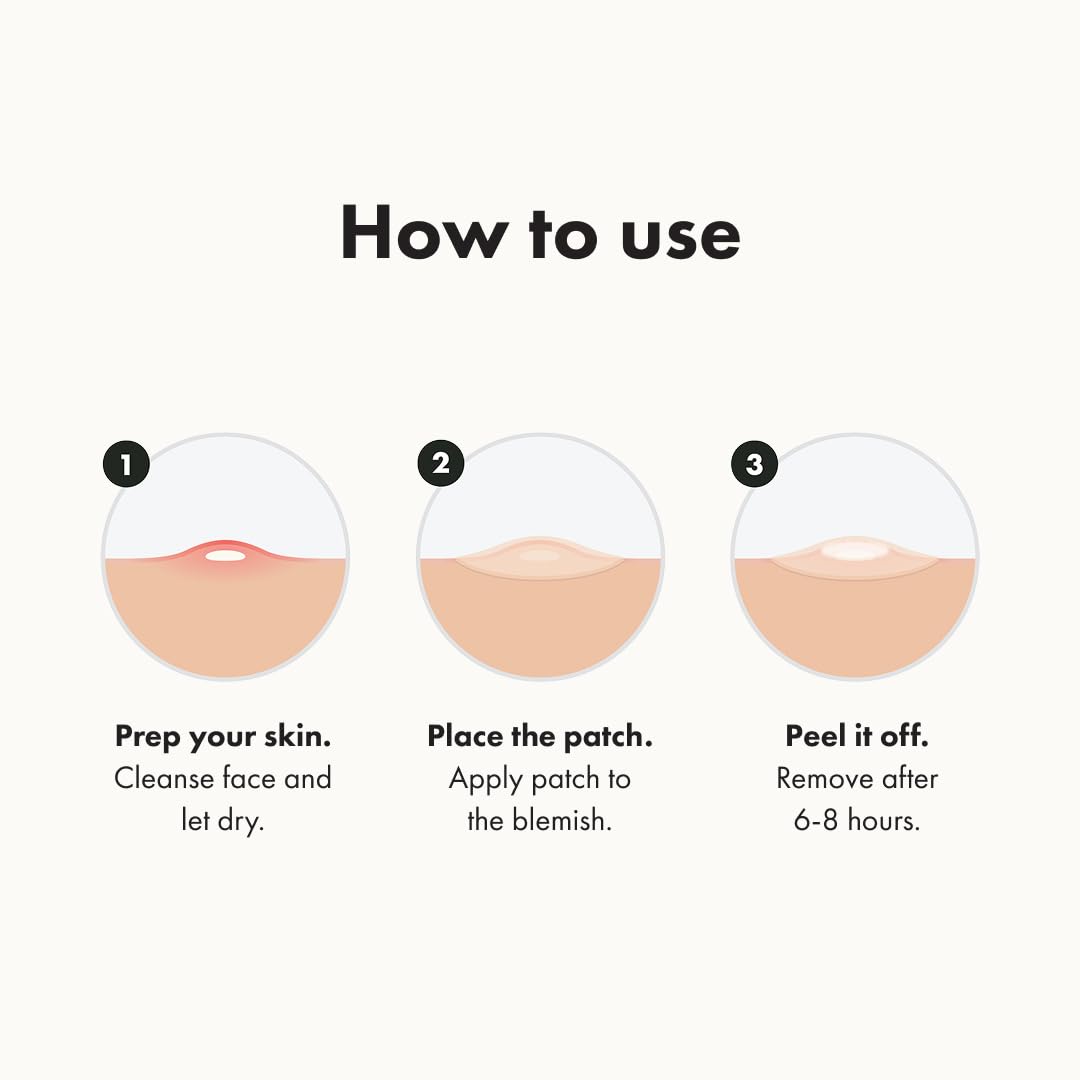 ™ Original Patch from Hero Cosmetics – the #1 Hydrocolloid Acne Pimple Patch for Shrinking Zits and Whiteheads in 1 Use; Nighttime Spot Stickers for Face and Skin (75 Count)
