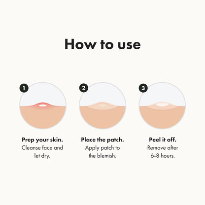 ™ Original Patch from Hero Cosmetics – the #1 Hydrocolloid Acne Pimple Patch for Shrinking Zits and Whiteheads in 1 Use; Nighttime Spot Stickers for Face and Skin (75 Count)